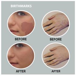 As Seen on TV Instant Cover Miracle Concealer