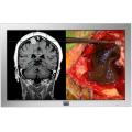 Barco MD-4221 42-inch High Definition LCD Medical Display